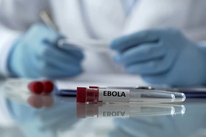 JSST rahbari Ebola virusining jahonda tarqalish ehtimolini baholadi
