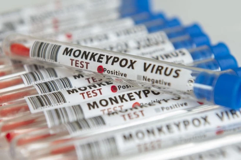 Дунёда mpox вирусини юқтирганлар сони 84 мингдан ошди