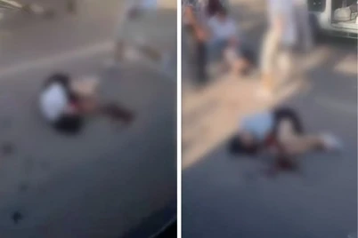 Olmaliqda “Damas” urib ketgan oʻquvchi qizlardan biri shifoxonada vafot etdi