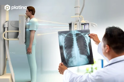 Rentgen apparatlari qanday ishlaydi?